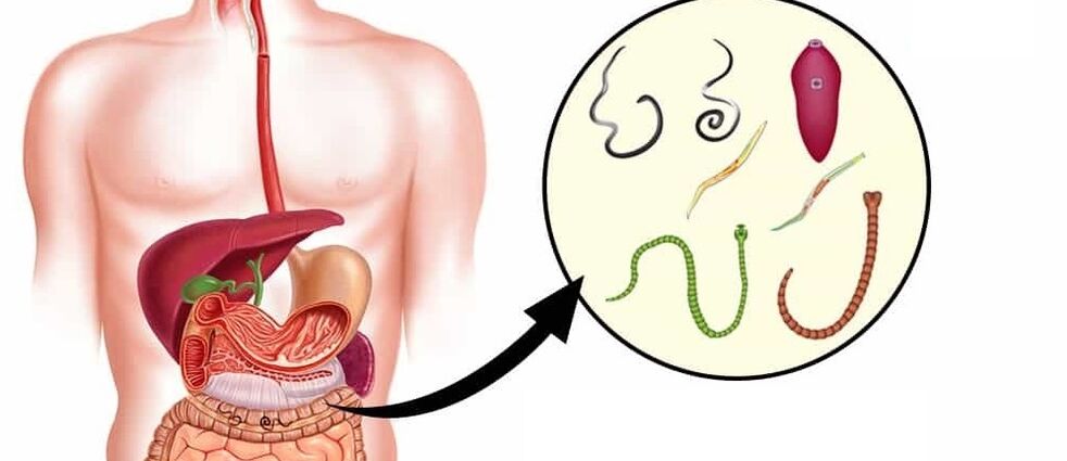 Parassiti nel corpo umano