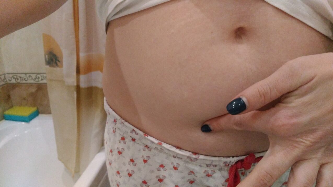 Segni di infezione da elminti per esperienza personale