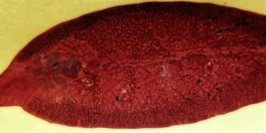 Parassiti trematodi, come rimuoverli dal corpo