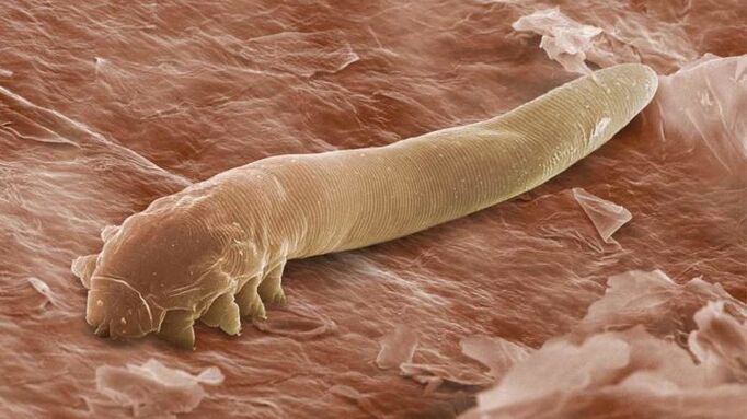 Parassita sottocutaneo al microscopio