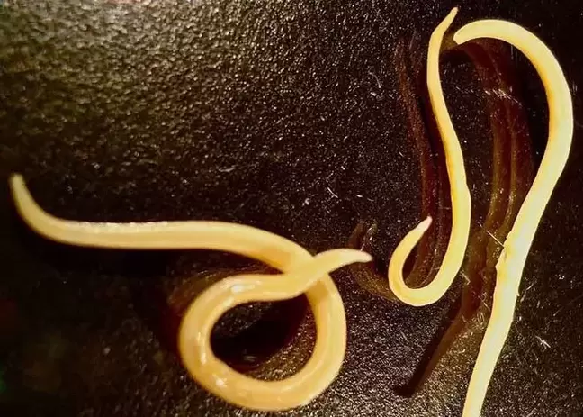 Parassita protozoico del corpo umano